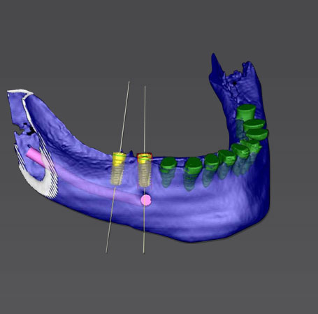 3D-Planung